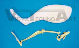 Feline hindlimb left, fractured, foam coat